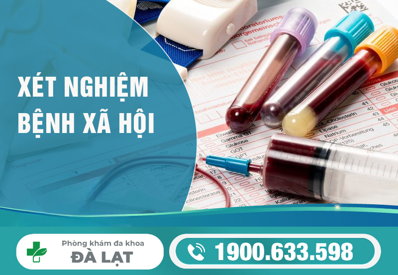 Hình ảnh minh họa